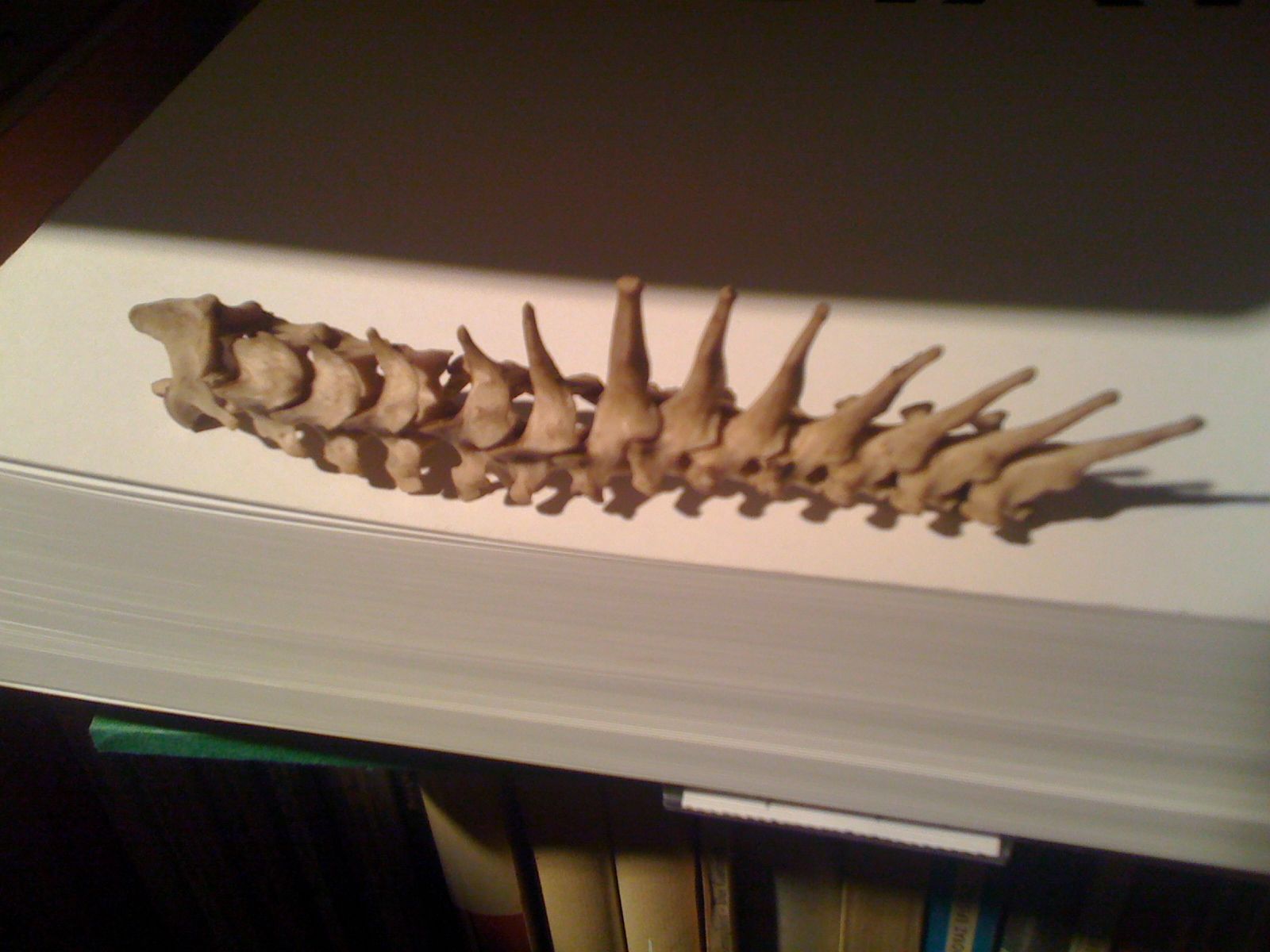 sezione di colonna vertebrale - di cosa?